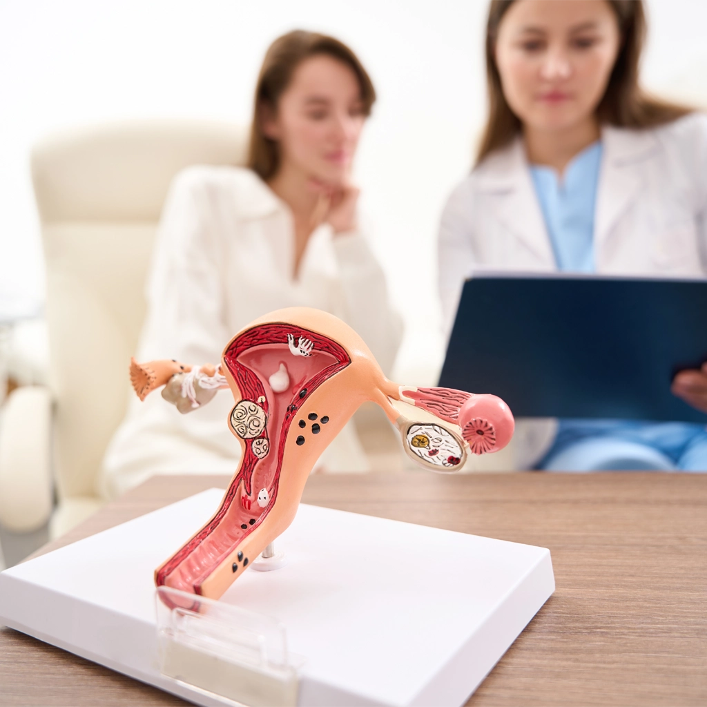 uterine fibroid embolization