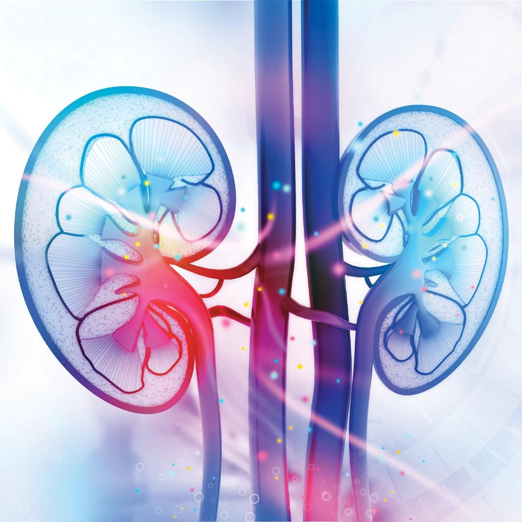 renal angiomyolipoma (AML)