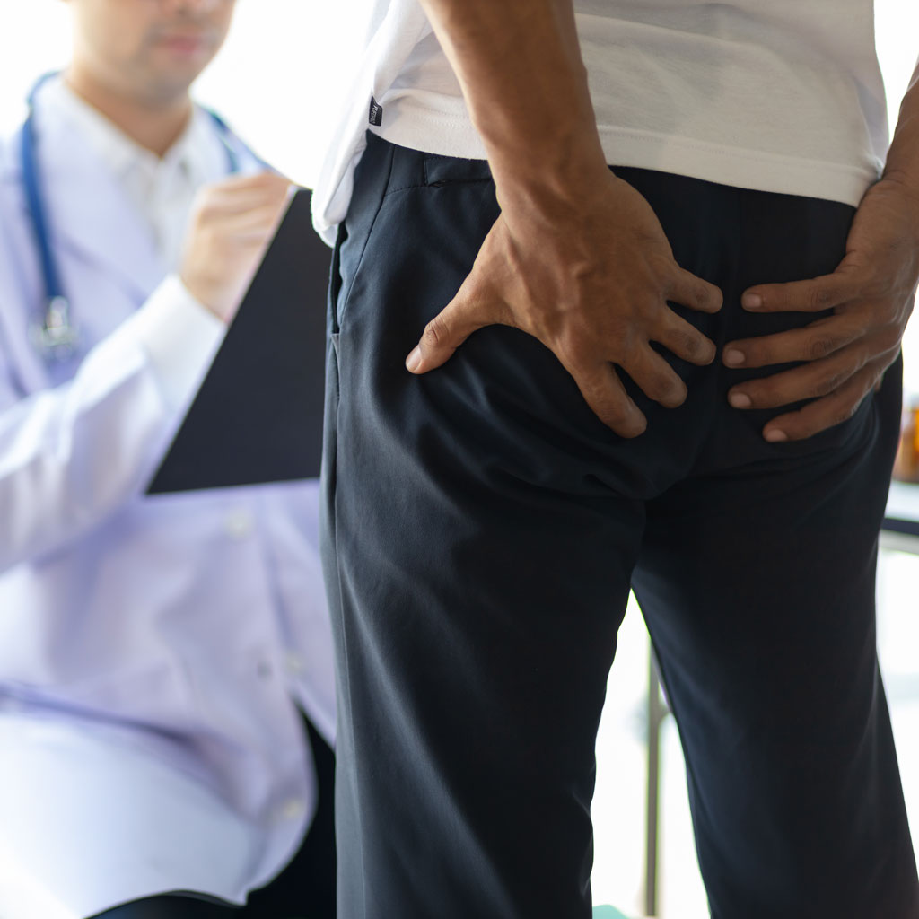 Man with Doctor Discussing Hemorrhoid Treatment Options